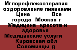 Иглорефлексотерапия, оздоровление пиявками › Цена ­ 3 000 - Все города, Москва г. Медицина, красота и здоровье » Медицинские услуги   . Кировская обл.,Соломинцы д.